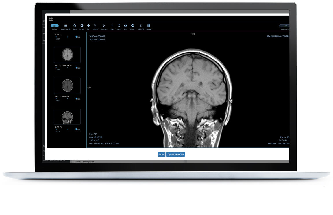 modern laptop showing a brain scan modern laptop showing a brain scan